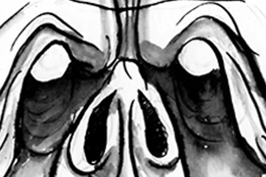 late rage 2